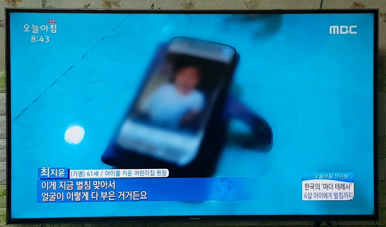 [17.11.15 MBC 오늘아침] 한국의 마더 테레사, 4살 아이에게 벌침까지5.jpg