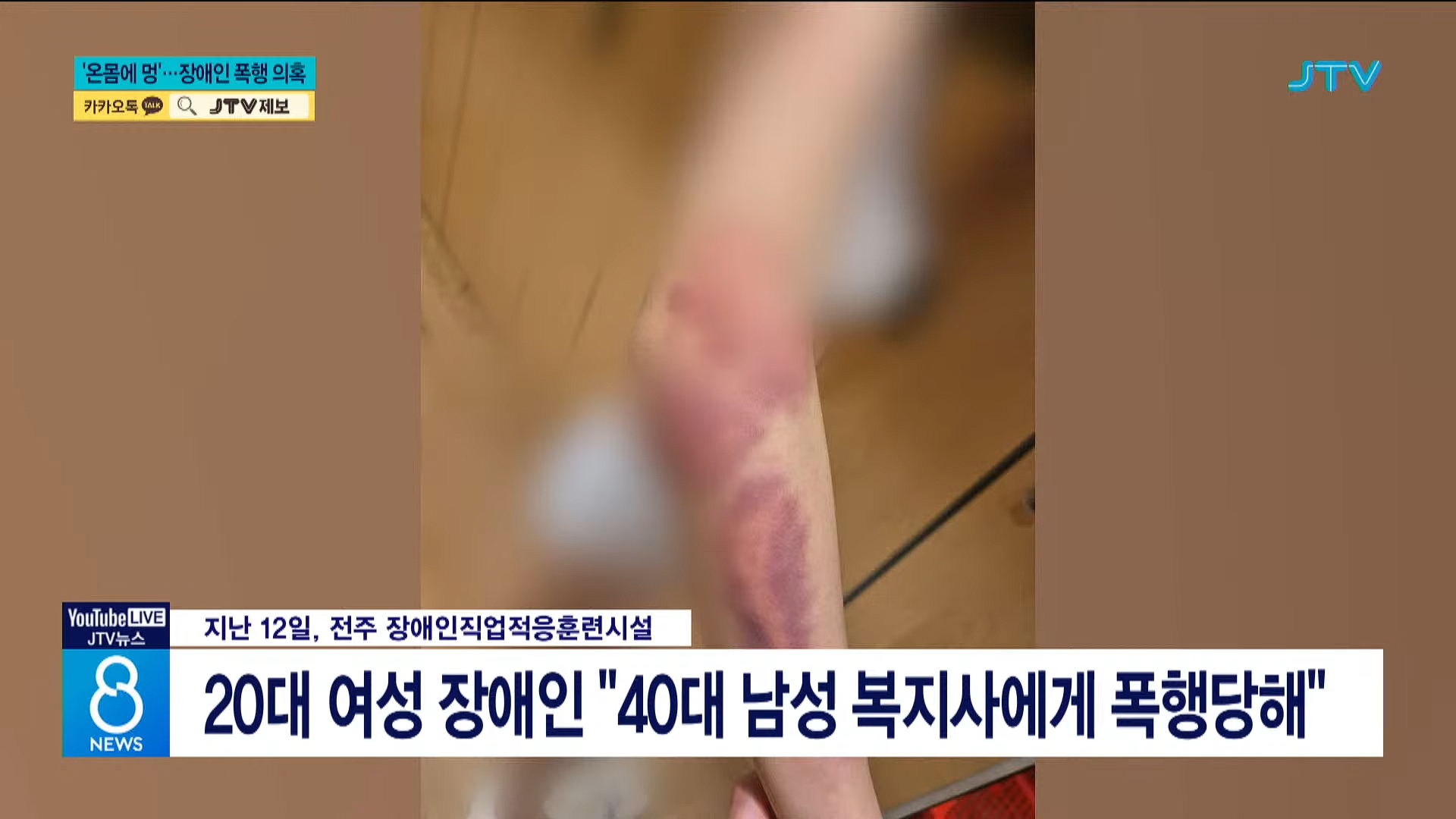 [26.5.31 JTV] 전주, '온몸에 멍'⋯사회복지사가 장애인 폭행2.jpg